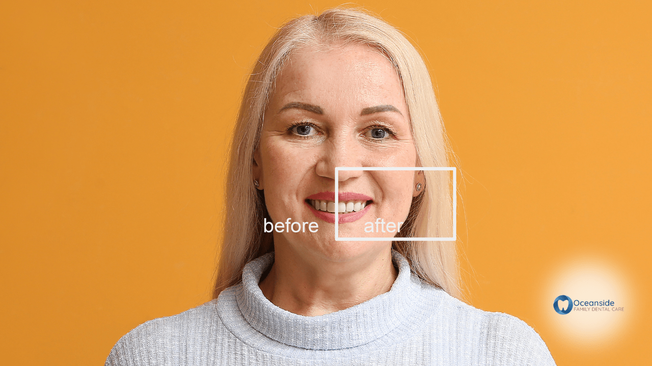 Anatomy of a Smile Makeover